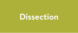 4. Dessection Mobile.png